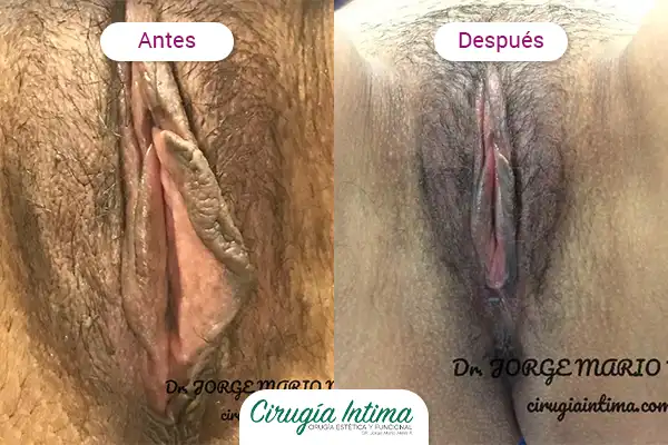 Imagen sensible